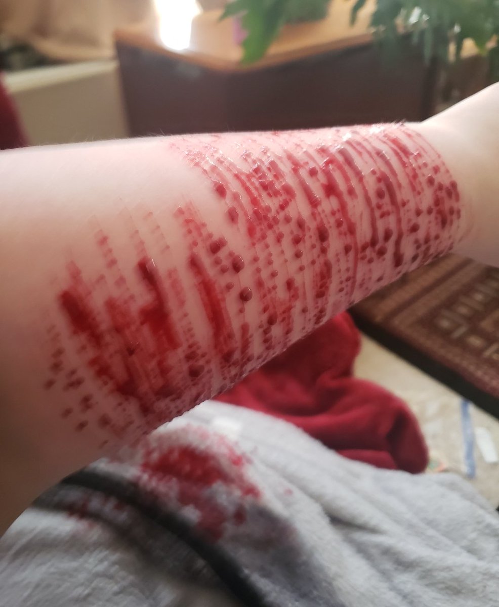 Shitnpee's tweet photo. TW/SH 
Some of my favorite pics (old, all are me) 
#Sh #Shtwt #slicey #armgills https://t.co/cenGqnHO8B