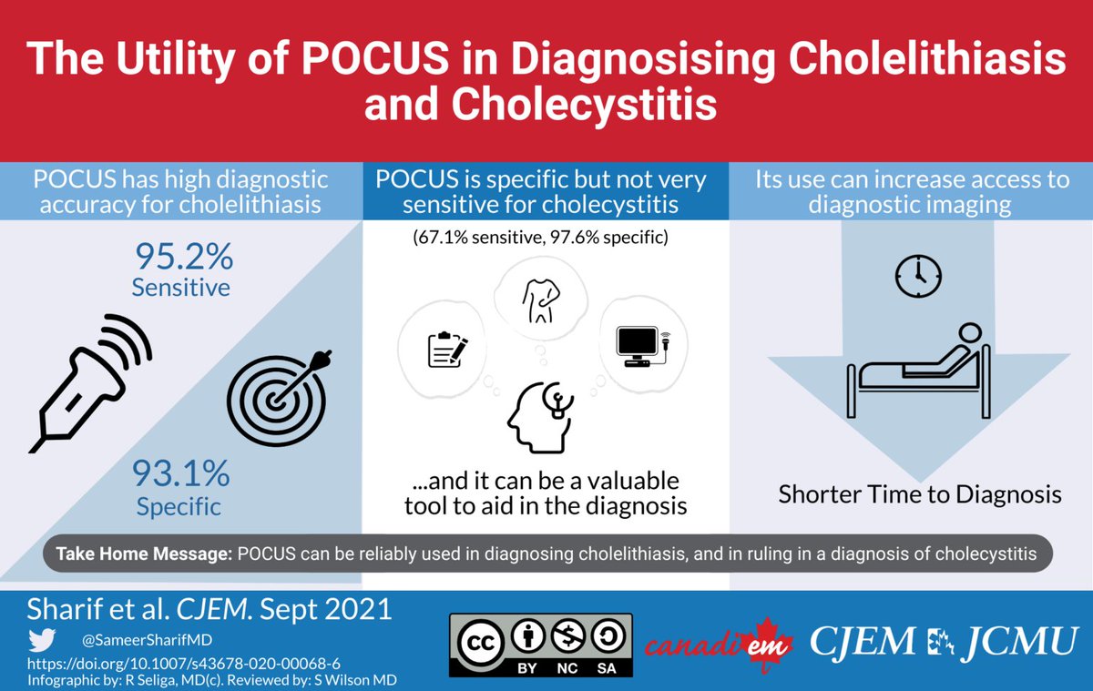 CJEM (@cjemonline) on Twitter photo Evaluating the diagnostic accuracy of POCUS for cholelithiasis and cholecystitis in a Canadian ED by <a href="/SameerSharifMD/">Sameer Sharif</a> <a href="/amhealey/">Andrew Healey</a> infographic by <a href="/WeAreCanadiEM/">CanadiEM</a> link.springer.com/article/10.100…
Conclusion: POCUS is reliable for the diagnosis of cholelithiasis and for ruling in cholecystitis. Evaluating the diagnostic accuracy of POCUS for cholelithiasis and cholecystitis in a Canadian ED by <a href="/SameerSharifMD/">Sameer Sharif</a> <a href="/amhealey/">Andrew Healey</a> infographic by <a href="/WeAreCanadiEM/">CanadiEM</a> link.springer.com/article/10.100…
Conclusion: POCUS is reliable for the diagnosis of cholelithiasis and for ruling in cholecystitis.
