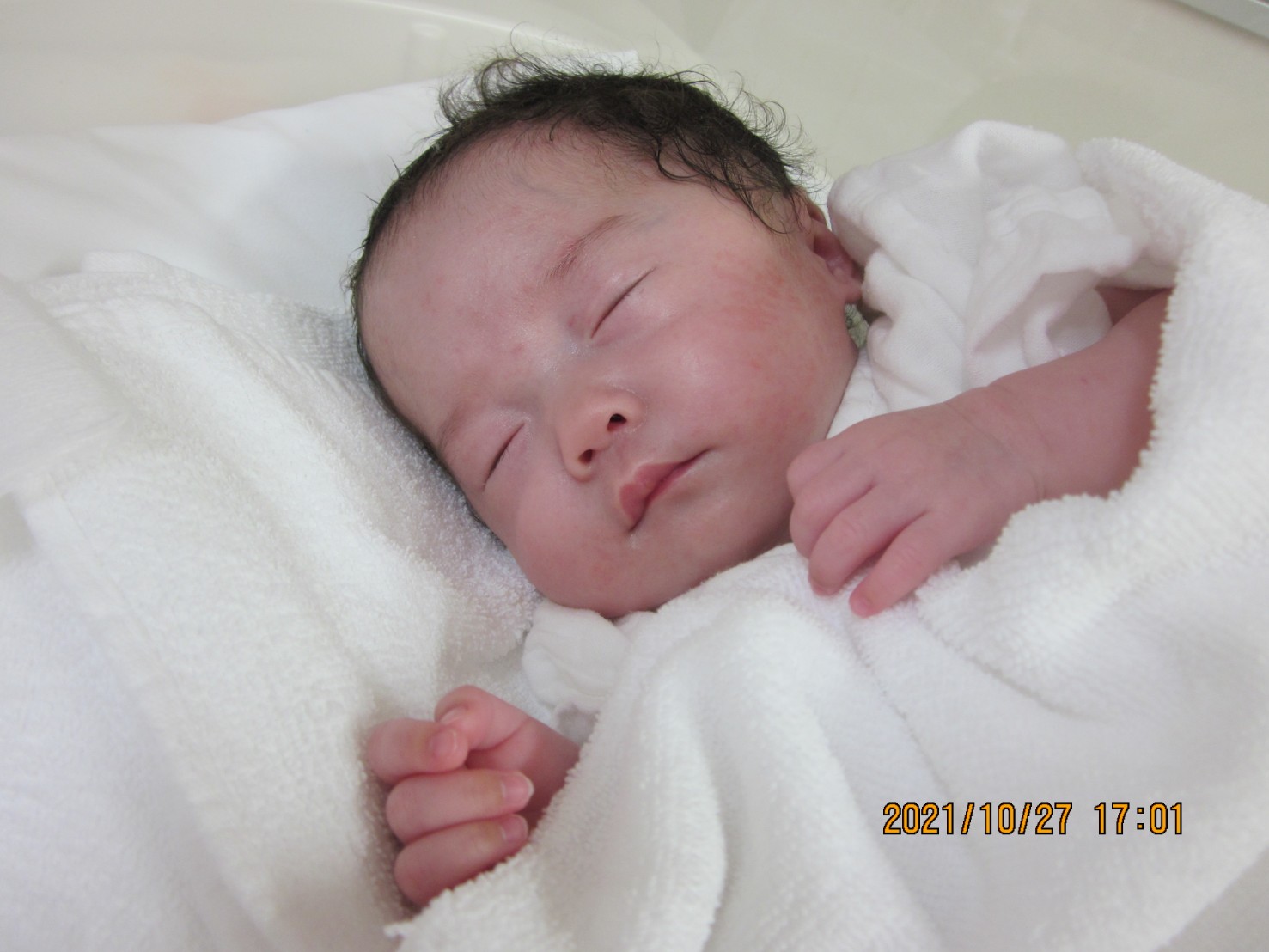 Matsumi 経鼻チューブ抜去 おめでとぉ T Co Z7j8fjluqz Twitter