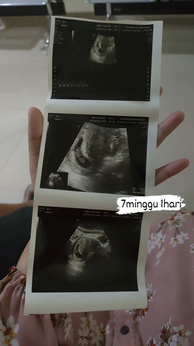 niiady's tweet photo. Hai sayang terima kasih sudah hadir dirahim mamah, kita akan sama sama berjuang 😘 https://t.co/EB910O2G5E