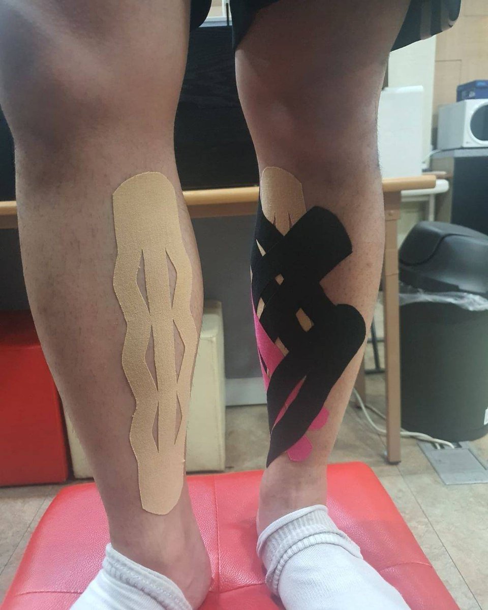 KinesioTape's tweet photo. #Repost @ryusangkyun_ #physicaleducation #Academy #Preparation #Running #Fatigue #Anteriortibialis #anteriormuscle #pain #shinsplints #kinesiotaping #basketweave #genuinetaping #kinesiotape #CKTT #CKTP #CKTP+ #PhDRyu #painrelief #ispykinesiotape #kinesio #tapewithwisdom https://t.co/jiceYgtl8P