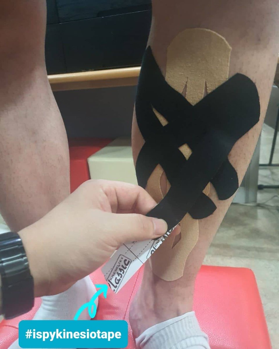 KinesioTape's tweet photo. #Repost @ryusangkyun_ #physicaleducation #Academy #Preparation #Running #Fatigue #Anteriortibialis #anteriormuscle #pain #shinsplints #kinesiotaping #basketweave #genuinetaping #kinesiotape #CKTT #CKTP #CKTP+ #PhDRyu #painrelief #ispykinesiotape #kinesio #tapewithwisdom https://t.co/jiceYgtl8P