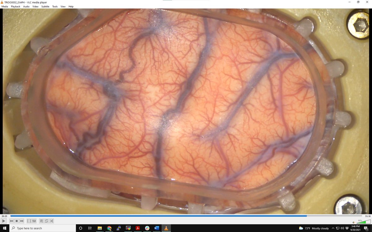 pesaranlab's tweet photo. Here's our latest brain window. Drop us a line if you want to use it to study multiregional communication and cognitive BMI using neuropixel arrays, microECoG, and multiphoton microscopy. Stop by the lab to see it in 3D. We're hiring! https://t.co/YnmoGdhu6F