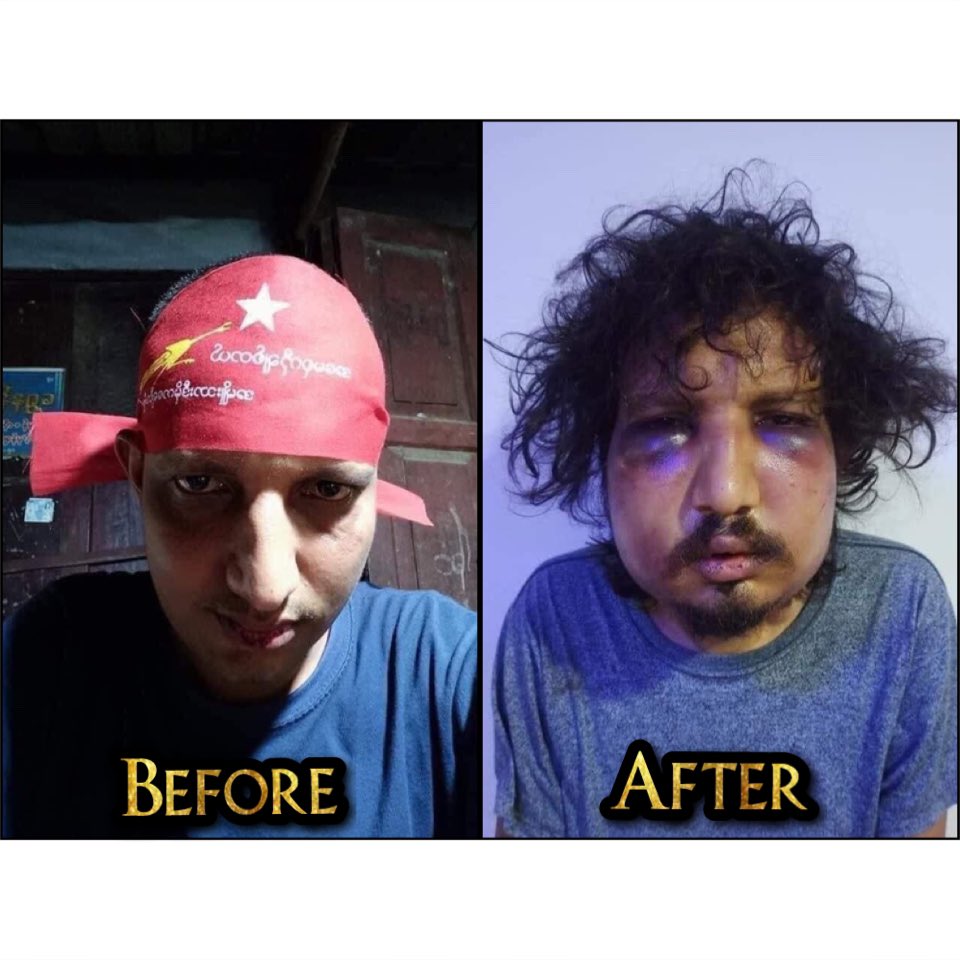 Ko Zin Maung Myint (alias) Kalar Lay was ABDUCTED by SAC Terrorist group in Monywa yesterday. He was brutally tortured during interrogation. Have a look the photos! 

#WhatsHappeningInMyanmar #Oct27Coup