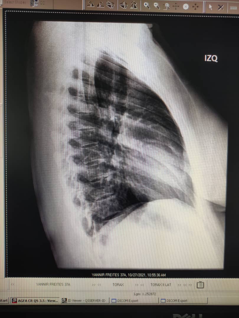 _ChavistaSoy's tweet photo. En medio de la impotencia por no saber qué hacer ahora que todos mostramos evidencias de COVID-19 solicito de la AYUDA del Estado @NicolasMaduro @AlvaradoC_Salud ¡No dejen morir a mi familia por favor! 

RX @YannirFreites y @SamanthaPabon3 
#VenezuelaSeVacuna #27Oct https://t.co/GevpytN93E