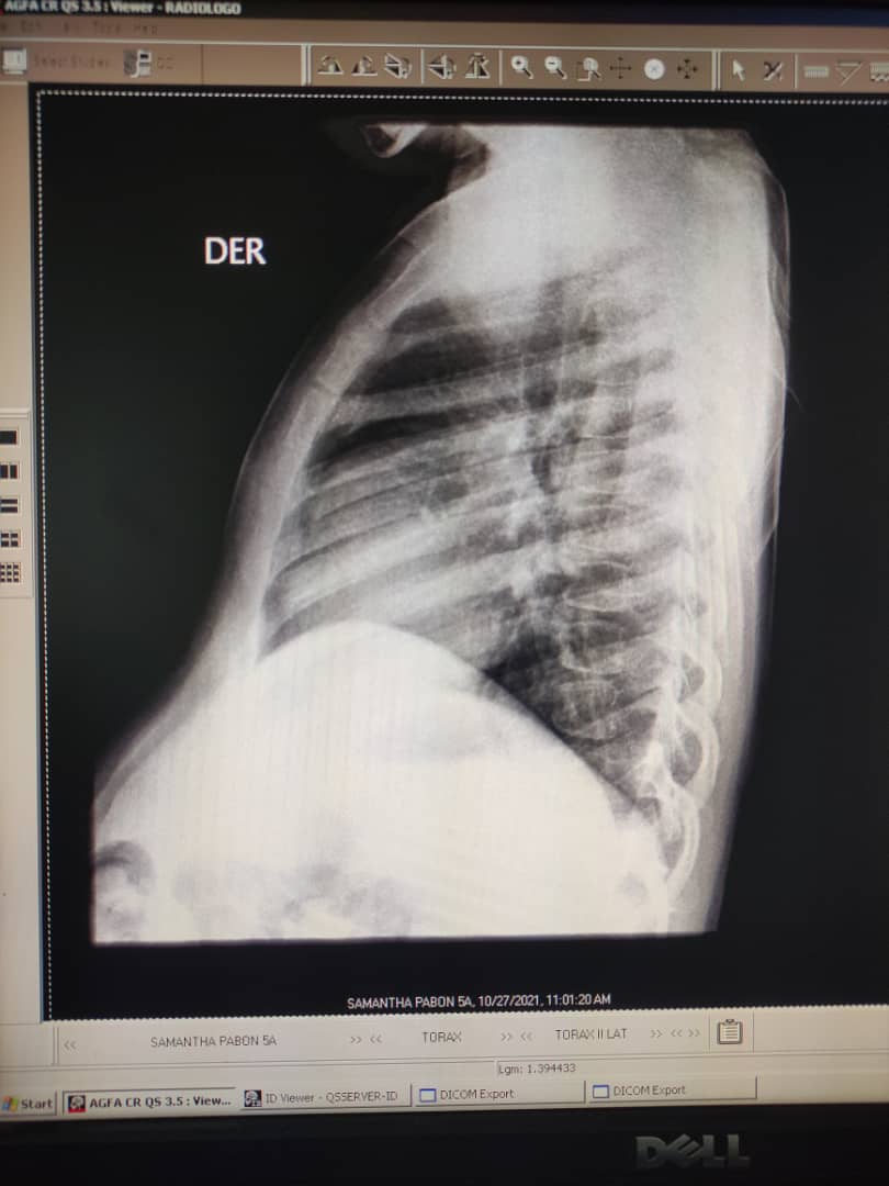 _ChavistaSoy's tweet photo. En medio de la impotencia por no saber qué hacer ahora que todos mostramos evidencias de COVID-19 solicito de la AYUDA del Estado @NicolasMaduro @AlvaradoC_Salud ¡No dejen morir a mi familia por favor! 

RX @YannirFreites y @SamanthaPabon3 
#VenezuelaSeVacuna #27Oct https://t.co/GevpytN93E