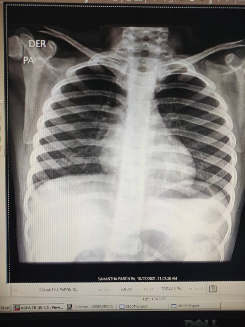 _ChavistaSoy's tweet photo. En medio de la impotencia por no saber qué hacer ahora que todos mostramos evidencias de COVID-19 solicito de la AYUDA del Estado @NicolasMaduro @AlvaradoC_Salud ¡No dejen morir a mi familia por favor! 

RX @YannirFreites y @SamanthaPabon3 
#VenezuelaSeVacuna #27Oct https://t.co/GevpytN93E