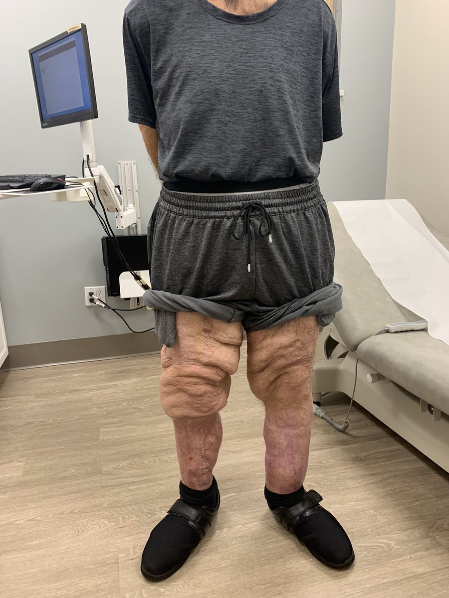 Kuldeep Singh MD tweet media