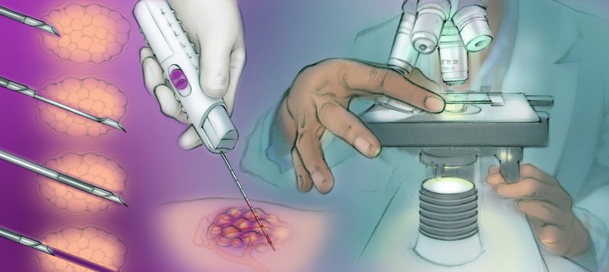 Interventional2's tweet photo. From diagnosis to treatment, IO offers minimally invasive care for patients living through cancer.  Learn more at @IOawarenessweek https://t.co/iPeAtEeeI1