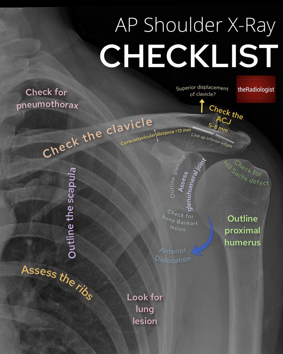radiologistpage's tweet photo. AP shoulder X-ray checklist and anatomy https://t.co/IA5fPeg0fz