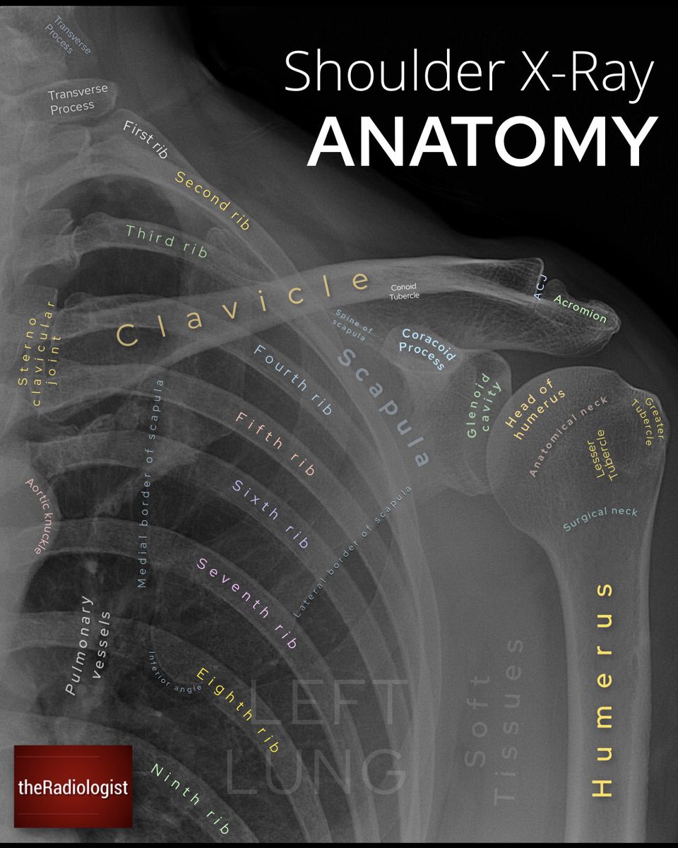 radiologistpage's tweet photo. AP shoulder X-ray checklist and anatomy https://t.co/IA5fPeg0fz