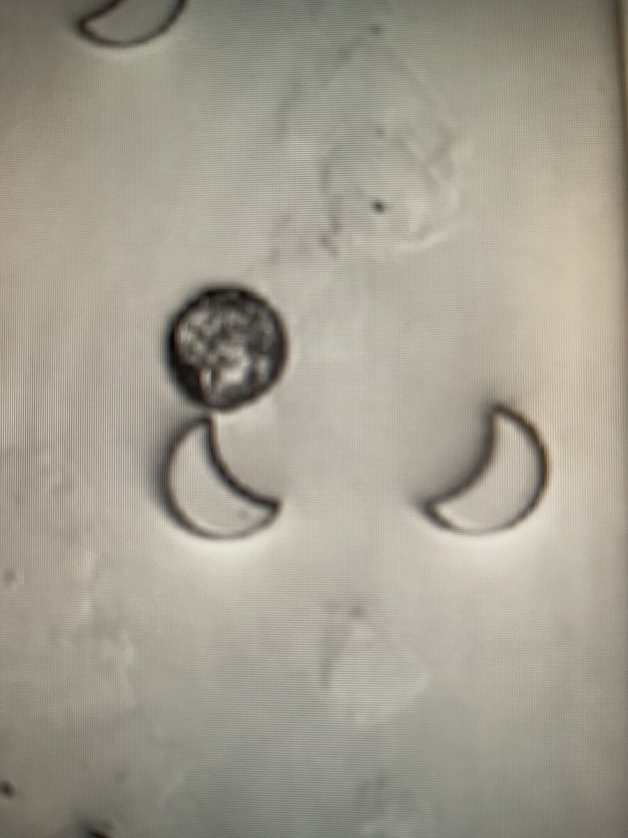 Look at the single intestinal enteroids/orgonoids captured in the microfluidic device I recently designed. I name it single orgonoid capture chip! Cant wait to see co-culture them in presence of bacteria.