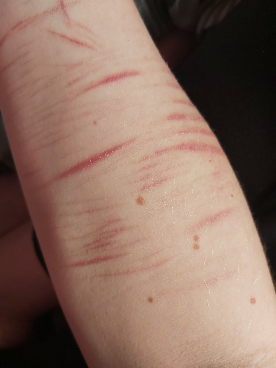 jovisinit's tweet photo. I was just Deeping it, its crazy the difference a year clean makes
#shtwt #redbreadtwt #madeofstyro #owchietwt https://t.co/YhRGZIFu5d