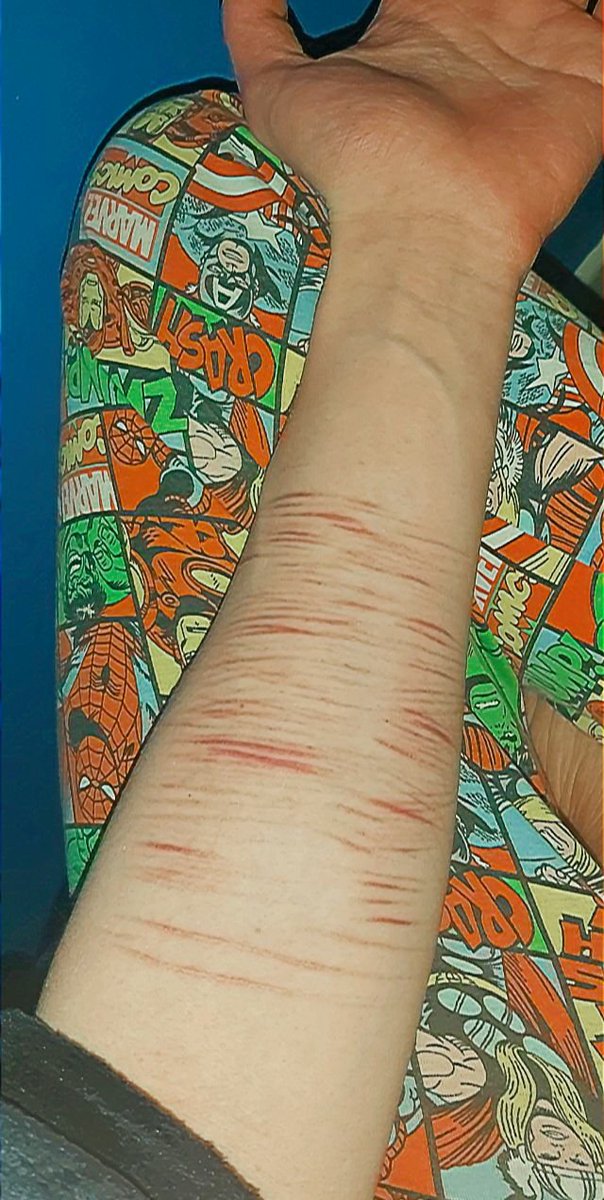 jovisinit's tweet photo. I was just Deeping it, its crazy the difference a year clean makes
#shtwt #redbreadtwt #madeofstyro #owchietwt https://t.co/YhRGZIFu5d