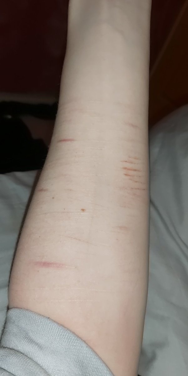 jovisinit's tweet photo. I was just Deeping it, its crazy the difference a year clean makes
#shtwt #redbreadtwt #madeofstyro #owchietwt https://t.co/YhRGZIFu5d