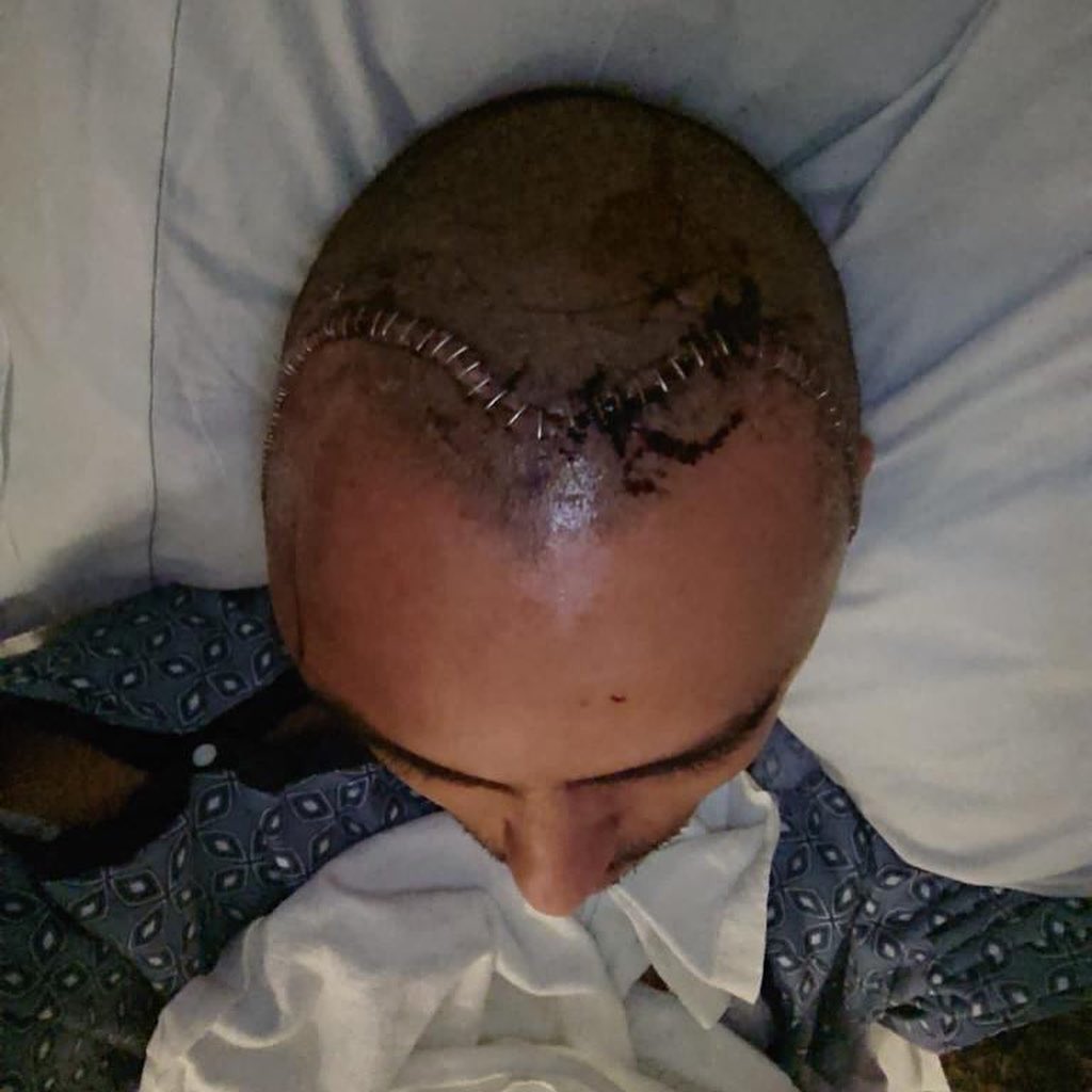 TheRiskingSpace's tweet photo. This week, actor/writer Tommy Mejia talks about making art after undergoing brain surgery. We talk about the frustration of not being able to make the art you want, why he's committed to creativity, &amp; the need for more nuanced representation of the Latinx &amp; Indigenous communities https://t.co/WoXaGxJbq2
