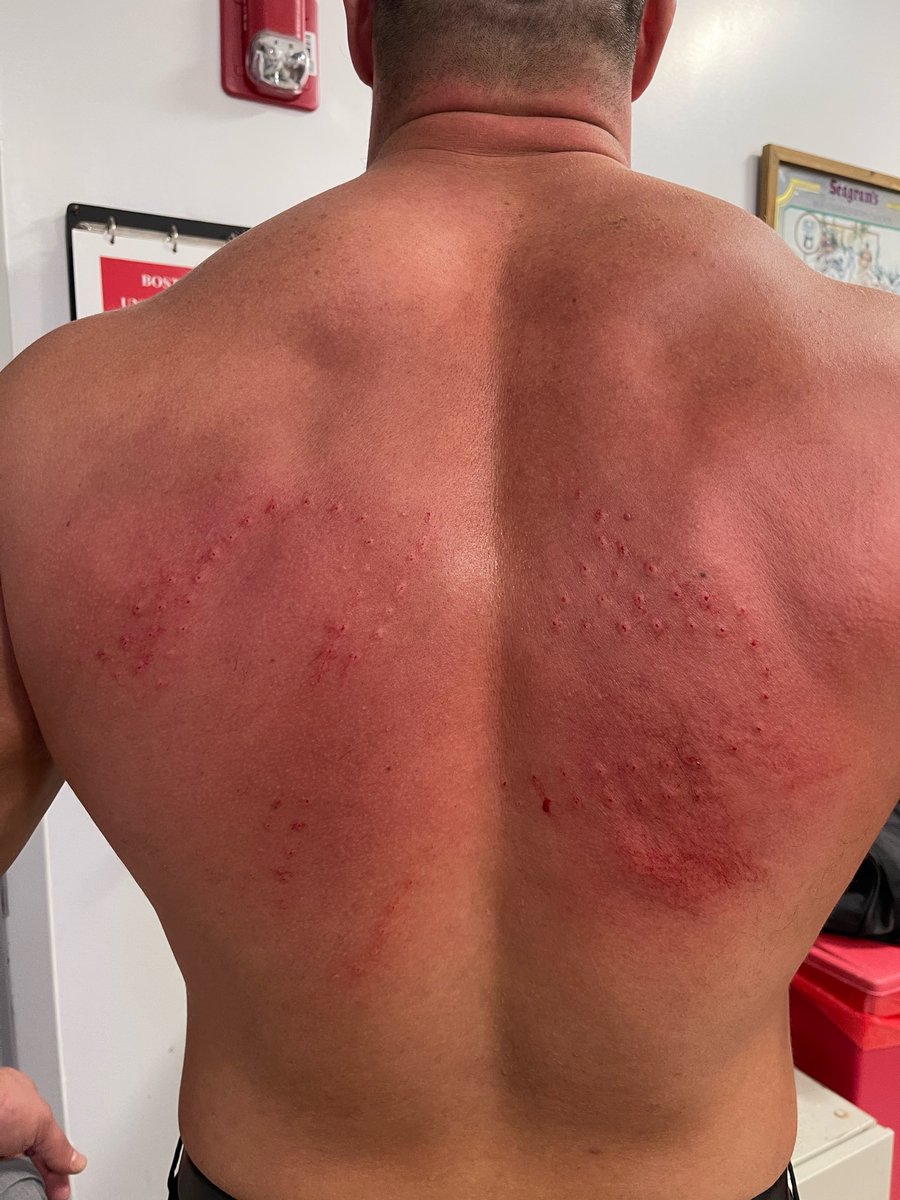 AEW's tweet photo. 👀  @RealWardlow’s back after being smacked with @DarbyAllin’s thumbtack skateboard on #AEWDynamite https://t.co/wc7xKaEoGj