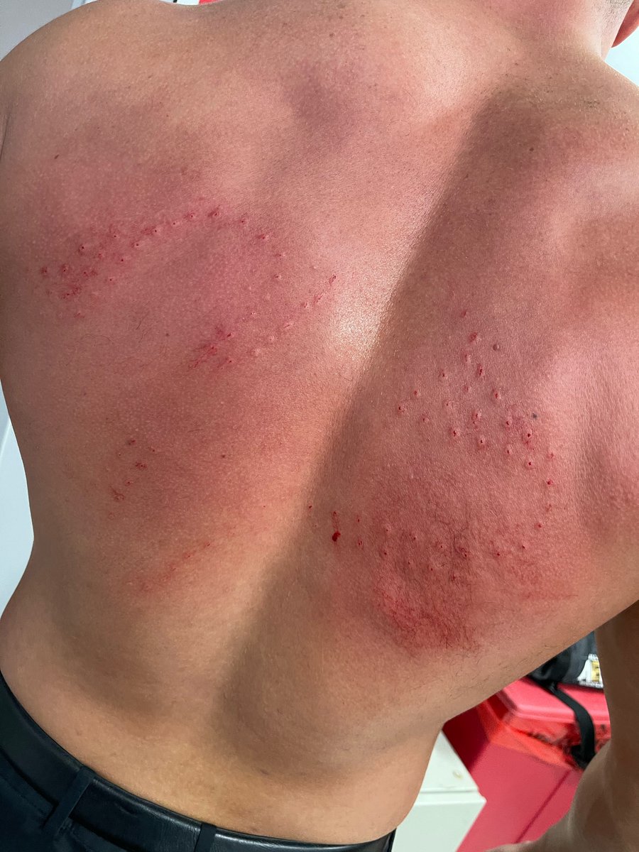 AEW's tweet photo. 👀  @RealWardlow’s back after being smacked with @DarbyAllin’s thumbtack skateboard on #AEWDynamite https://t.co/wc7xKaEoGj