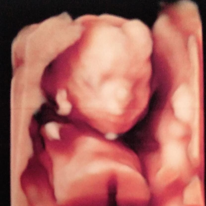 BeckerAlice's tweet image. Vem Isis ,mamãe e papai já te ama ❤ #maternidade #maedemenina