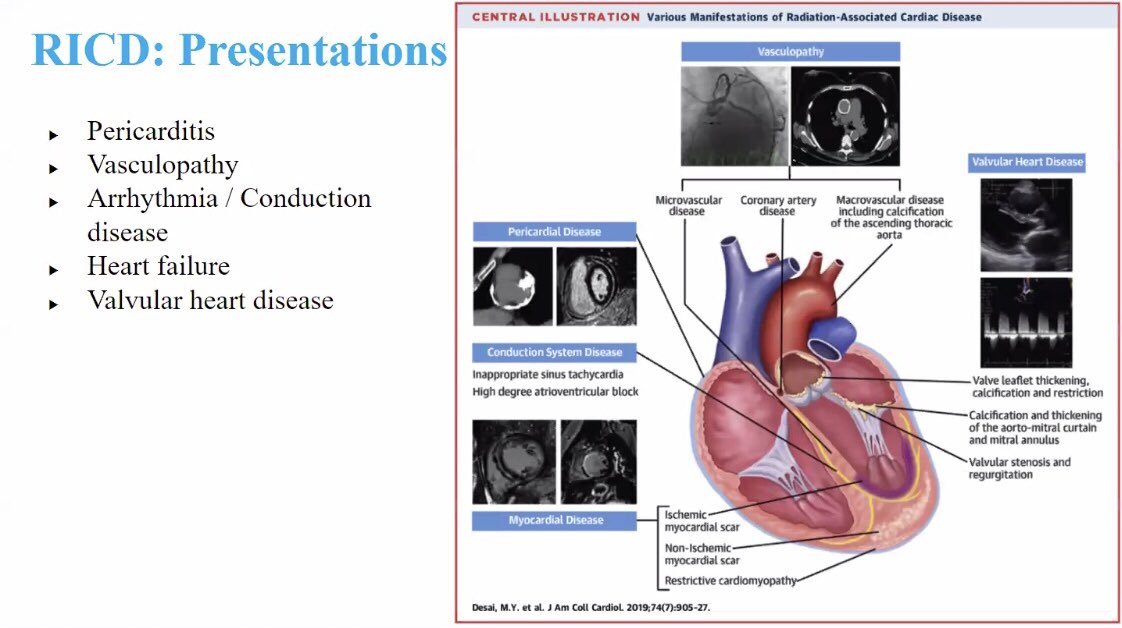MSHCardsCT's tweet photo. Love it when we take a deep dive into a topic with everyone in the program, including Drs. Halperin and Liao! This weekβs case-based #JLHConference was presented by @M_CagliostroMD who gave us an awesome overview on radiation-induced CV disease!π«#cardiotwitter #CardioOnc https://t.co/ygEKBBgT2O