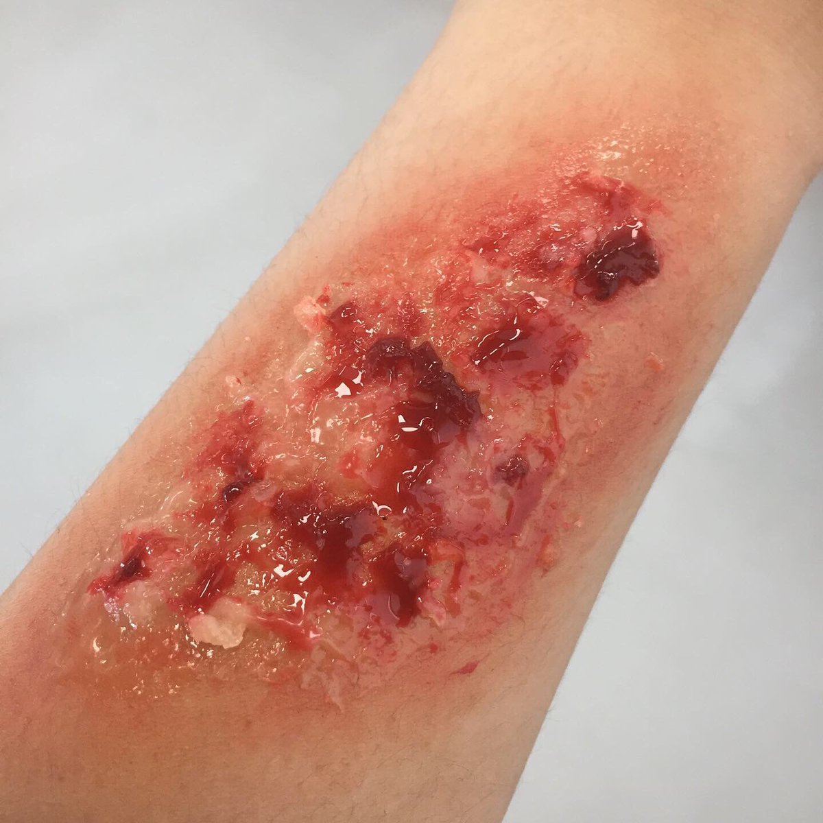 Powderpuff_Room's tweet photo. SFX wound Makeup at @UniNorthants @UONHMPSS 🖤✨
#makeup #sfxmakeup #sfx #sfxgore #sfxmua #sfxstudent #sfxwound #woundmakeup #bulletwound #bulletwoundmakeup #sfxburn #wound #specialeffectsmakeup #kryolan #northamptoncollege #northampton https://t.co/4ySTCyPMEr