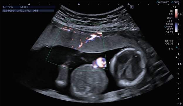 ImperialNHS's tweet photo. Doctors at Queen Charlotte's &amp; Chelsea Hospital have completed a world first non-invasive procedure to safely treat #TwinPregnancy complications.

Read ➡️ https://t.co/1iuFuAr2sF https://t.co/f82HGDmCAK