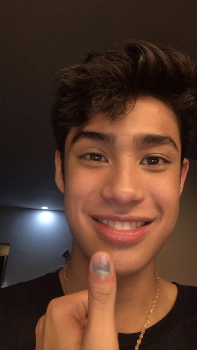 _urjanelle's tweet photo. Hellooooo @donnypangilinan sana maging maayos na yung nail mo na naipit mo sa door ng car hahaha charot matagal na pala yon 🤪

buti pa yung nail tumubo na ulit comeback when hahaha chos

✨DonKiss Family✨ 
#DonKiss | #DonKissFam https://t.co/NWlyTlHooC