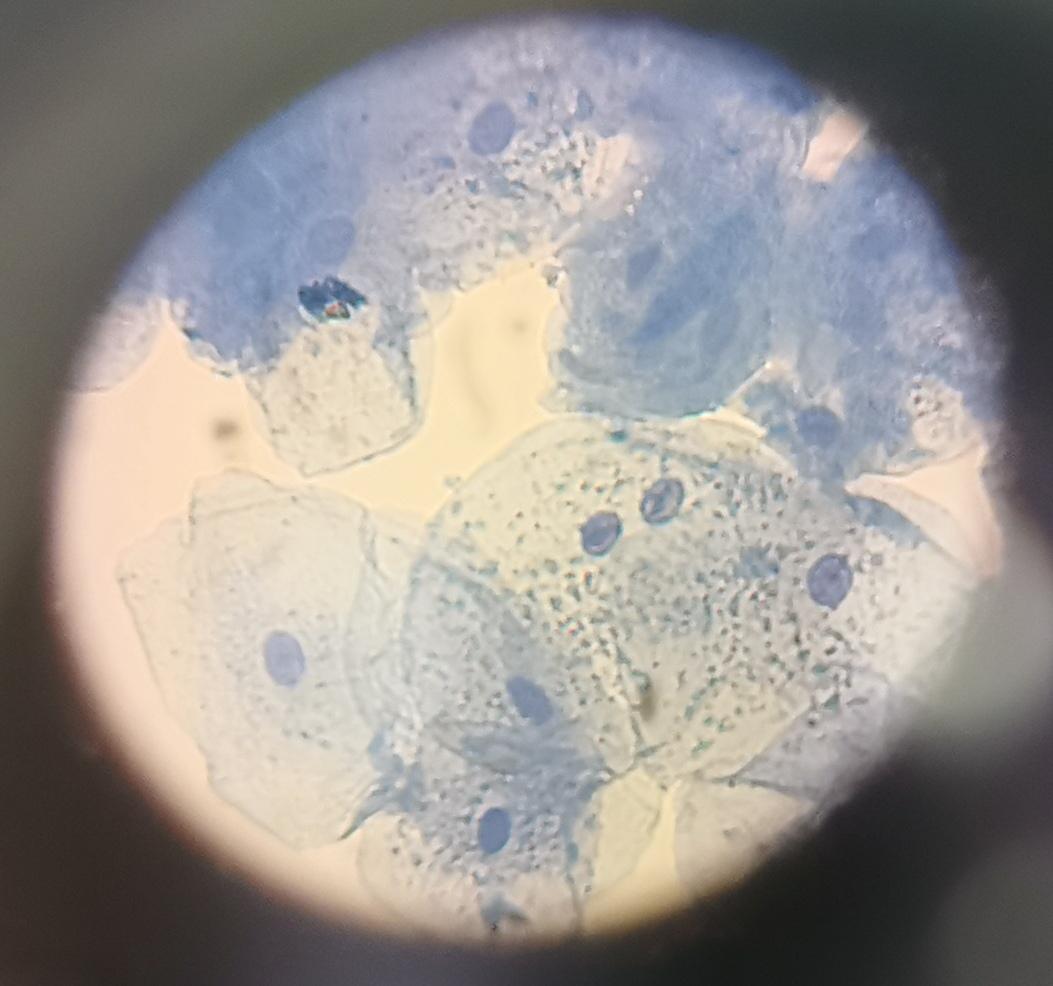 Jude_est82's tweet image. Some of my cheek cells under a microscope. 🔬 #AcademicTwitter #SciencePerspective #ScienceStudent #Microscopy #Cells