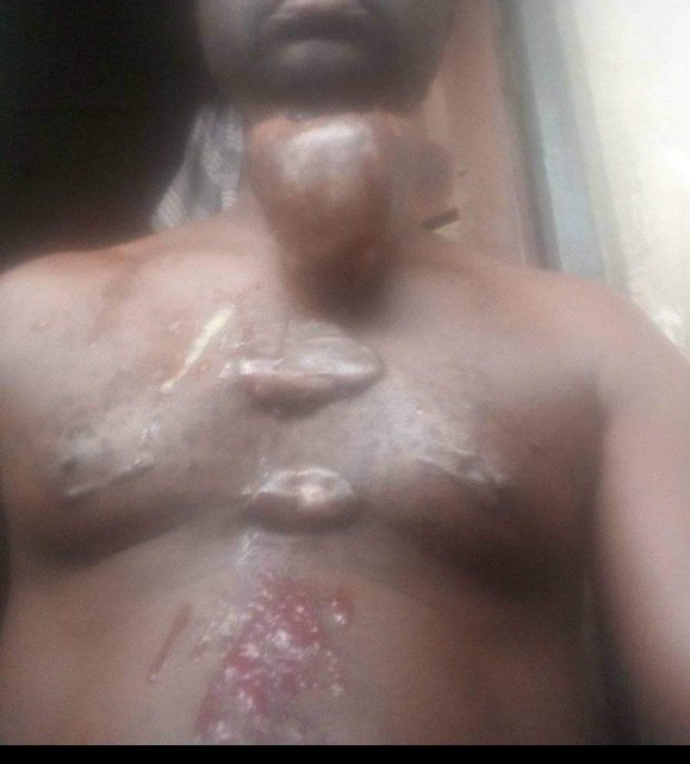 ItsDaBosz's tweet photo. @DONJAZZY @LadiPoe @fireboydml I believe my day has come pls kindly help me go for surgery https://t.co/X3M1sLAgOv