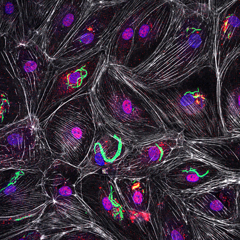 Max Gutierrez (@maxgabgut) on Twitter photo 💥Post-doc opportunity to join our lab <a href="/TheCrick/">The Francis Crick Institute</a>! Interested in quantitative cell biology and image analysis? We are developing new imaging technologies to visualise the interface between host cells and TB bacilli. Please apply and share.
28hv.short.gy/BrPsgy 💥Post-doc opportunity to join our lab <a href="/TheCrick/">The Francis Crick Institute</a>! Interested in quantitative cell biology and image analysis? We are developing new imaging technologies to visualise the interface between host cells and TB bacilli. Please apply and share.
28hv.short.gy/BrPsgy