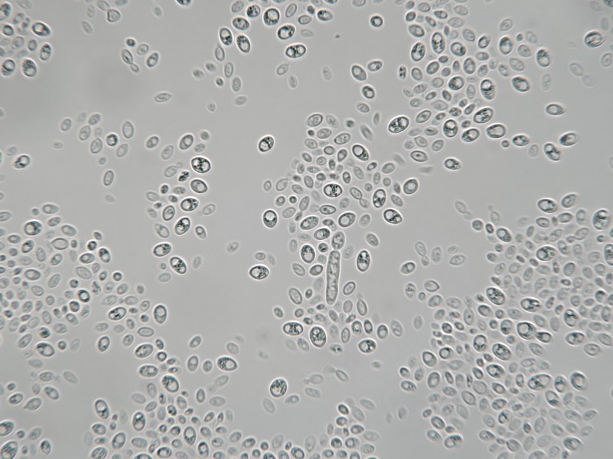 𝘉𝘶𝘳𝘦𝘭𝘭𝘢 𝘢𝘭𝘣𝘢 is a Basidiomycete yeast closely related to Cryptococcus and Fillobasidium. Apparently not isolated from human samples so far? Cream coloured & mucoid colonies. It was growing from BAL fluid culture from a pt on prednisone.