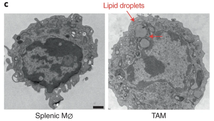 NatImmunol's tweet photo. Tumor-associated macrophages (TAMs) support an immunosuppressive tumor microenvironment. Di Conza et al. uncover how ER stress responses pathways are engaged to orchestrate pro-tumorigenic features and survival in TAMs by tumor-derived lipids. https://t.co/Ky8n864SXP @PCHo_Lab https://t.co/m0QSFXsBjq