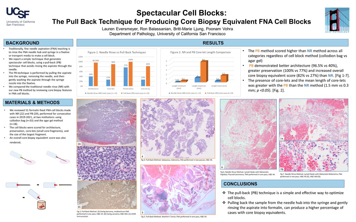 Getting excited about the American Society of Cytopathology Annual Scientific Meeting in LAS VEGAS. Well Las Vegas adjacent- better! 
Keeping the cell block dream alive with our SPECTACULAR CELL BLOCKS poster. 
#ILoveAGoodCellBlock
#ASC2021 @UCSFcytopath @cytopathology