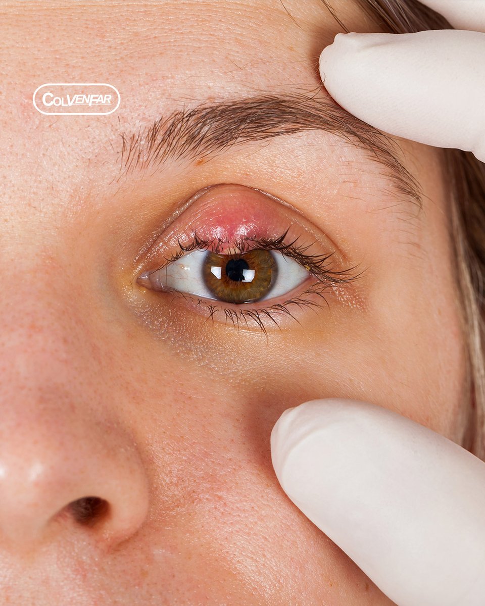 colvenfar's tweet photo. Tonimer eyes. Coadyuvante en el manejo de afecciones oculares causadas por la obstrucción anómala de los conductos lagrimales.

🛒 https://t.co/zYhN54Igf7
#Colvenfar #tonimer #tonimereyes #eyes #ojos https://t.co/V1hLf4I51o