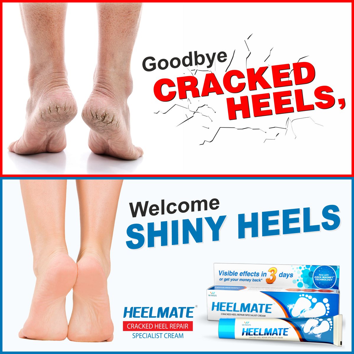 WingsPharma's tweet photo. Goodbye👋 Cracked Heel &amp; Welcome Shiny Heels with #Heelmate Heel Repair Cream - A Medically Proven and Clinically Recommended Treatment for #Dry &amp; #CrackedHeels that shows results within 3days - Gives Intense Moisturization, Highly Effective &amp; Promotes Skin Nourishing! https://t.co/7bXYNaPb4E