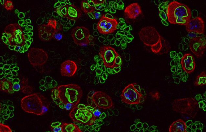 IBDMmarseille's tweet photo. #PhDposition available in #DevelopmentalBiology “#microRNA dynamics and function during #neurogenesis @MaurangeLab https://t.co/42hmS82i1M https://t.co/sLQgdwwidg