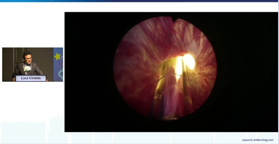 Boston Scientific Urology tweet media