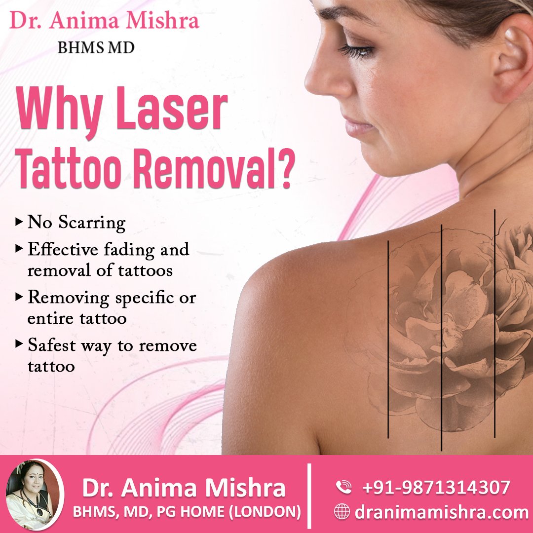 Tattoo Removal – Arlington Skin Doctor