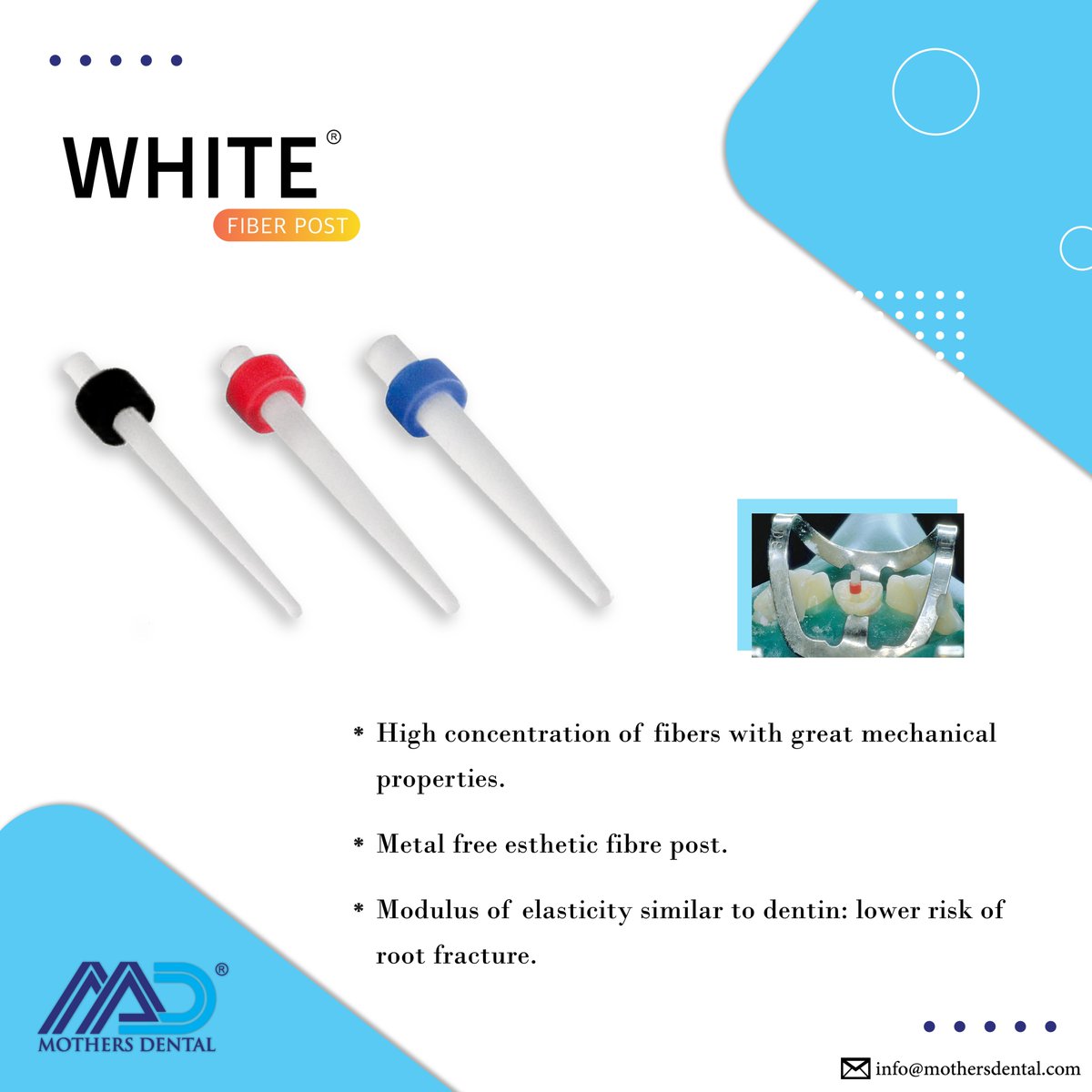 Mothersdental's tweet image. White Fiber Post  is a Highly Translucent Glass Fiber post exhibits  Cylindro-Spiro-Conical design  with excellent Radio Opaque features  and High Compressive Strength.
#fiberpost #endodontics