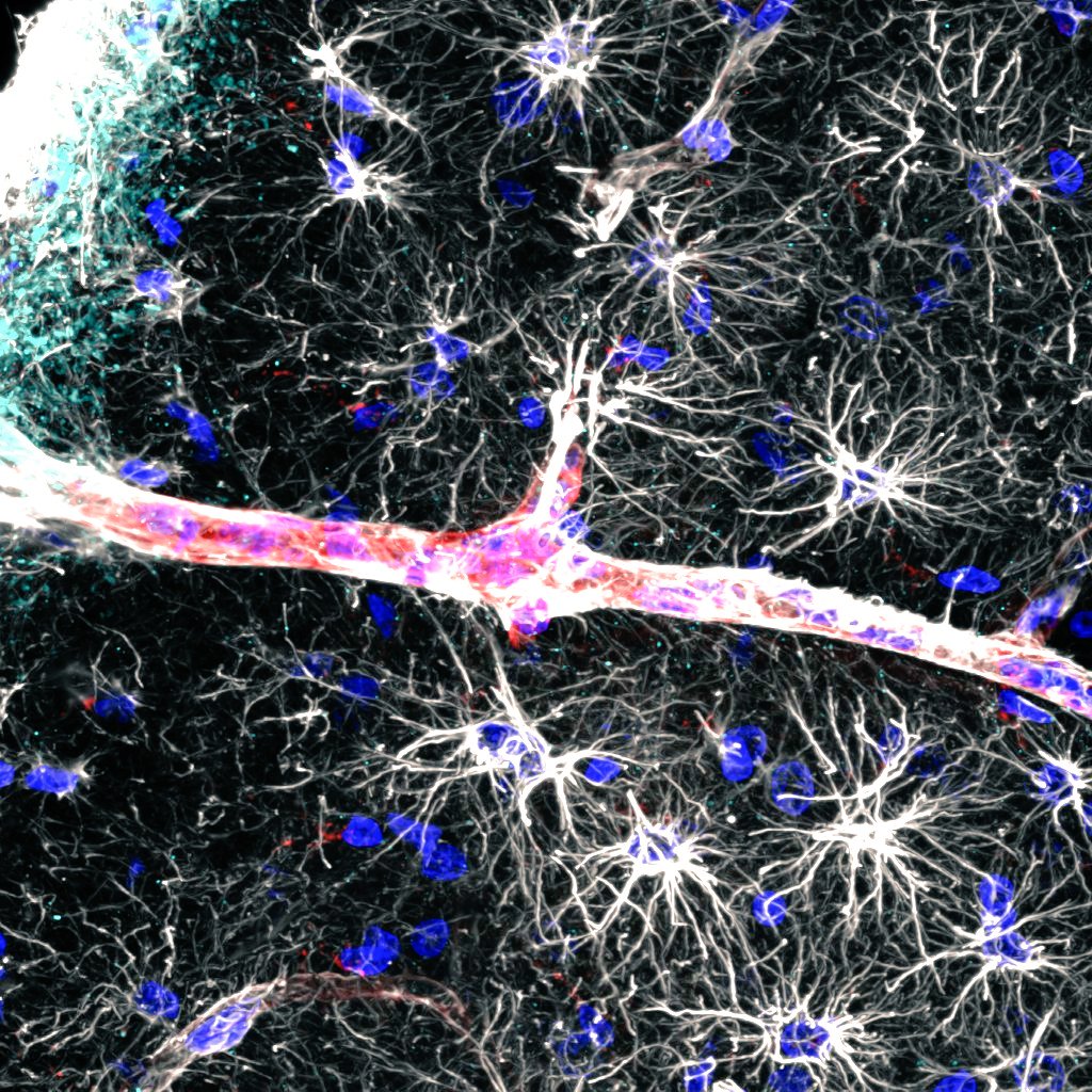 Brain surface to the left 🧠 Penetrating artery through 🌶️
Astrocytes all around ✨

#astrocytes #sciart #art #neuroscience #glymphatics
