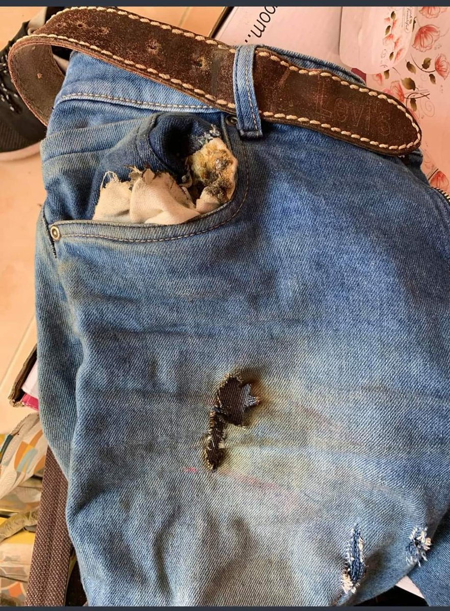 rajinikshtriyan's tweet image. மீண்டும் வெடித்தது ஒன்பிளஸ் நார்டு 2: உரிமையாளர் படுகாயம்!

#OnePlusNord2 #OneplusBlast