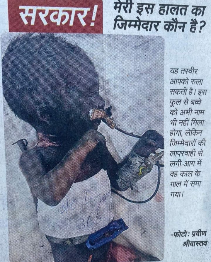 Extremely sorry to share....but we must know how safe we are..?
How responsibile we are? How responsibile our government is. Even Govt Institution don't fullfill safety norms.
<a href="/AshuGupta86/">Ashu Gupta</a> <a href="/narora141/">neeraj arora</a> <a href="/NYCI4Rajasthan/">NYCIRajasthan</a> @zeemanishsharma