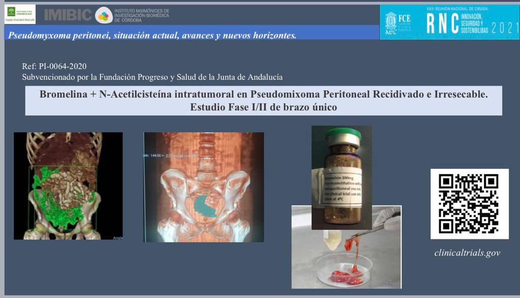 alarjosan's tweet photo. Proud to be invited by @rncirugia2021 to talk about the last findings in #pseudomyxomaperitonei @aecirujanos @operarelcancer @APeritoneum @IMIBIC @HUReinaSofia https://t.co/CeYy1Ey73w