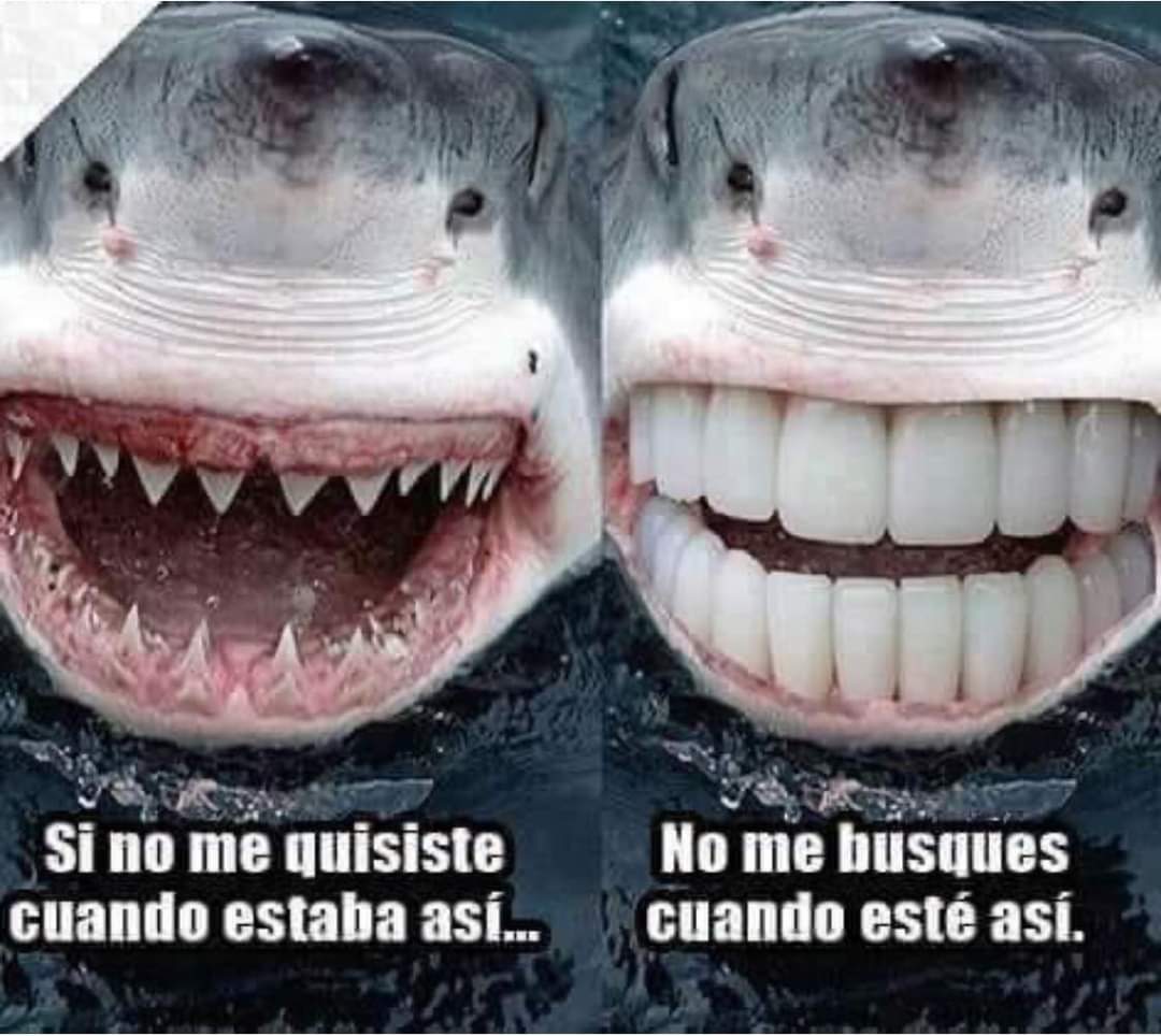 DentalPerfectDP's tweet photo. Si no te gusta tu sonrisa, busca una buena opción. Lo barato sale caro
#DejanosFasinarte
#DentistaCDMX
#DentistaTlalnepantla
#UrgenciaDental
#DolorDeMuela
#DolorDental
#LimpiezaDental
#Resinas
#SacarMuela
#Brackets
#BlanqueamientoDental 
#MuelasDelJuicio 
https://t.co/MDrxSMYH5t https://t.co/mnsXYzhAua