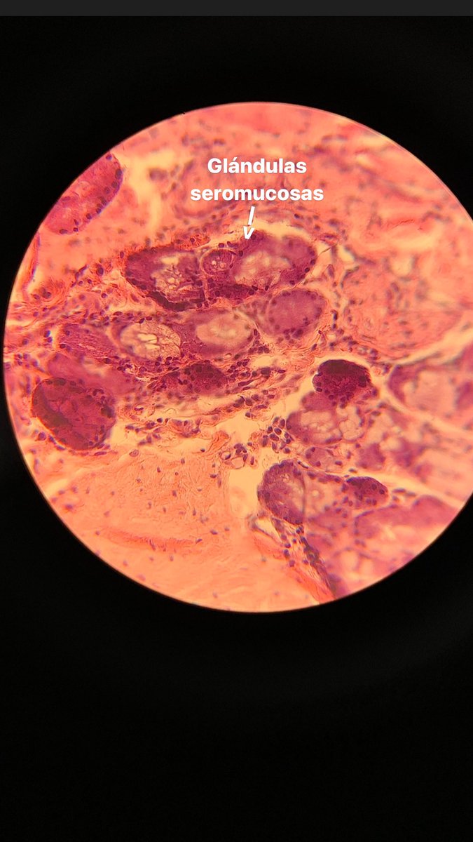 Muestra histológica de tráquea. Microscopio n*1 #histo2122med222