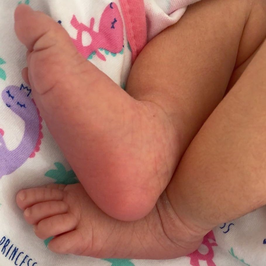 DelhiTimesTweet's tweet photo. Indian hockey captain @manpreetpawar07 and wife @illisaddique blessed with a baby girl
#ManpreetSingh #Parenthood #BabyIsHome #IndianHockey https://t.co/mLiOQWuORq