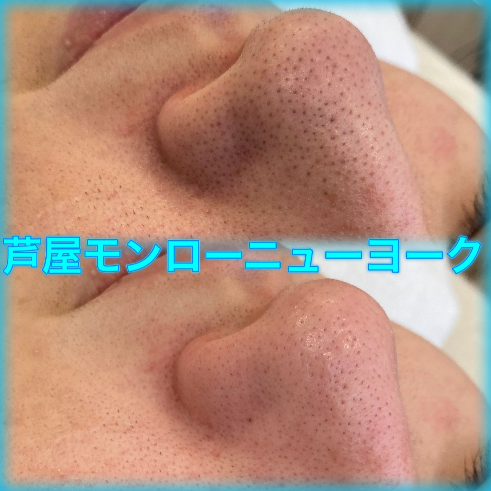 毛穴エクストラクション モンロー三谷 メンズいちご鼻ビフォアフ とりあえずメンズこそエクストラクション受けて欲しい 目に見えて改善が実感できる 毛穴 エクストラクション 角栓 T Co Tj48qdenjn Twitter