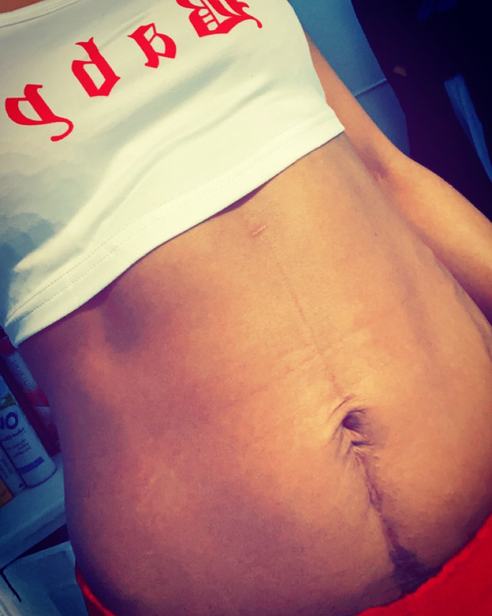 uniqueV28's tweet image. Be proud of your scars always they make you you!