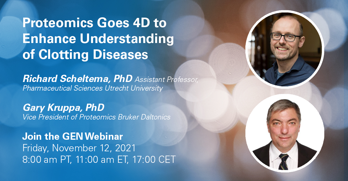 BrukerMassSpec's tweet photo. Do not miss this webinar, Friday, Nov 12th, with Richard Scheltema, PhD from Utrecht University, about cross-linking mass spectrometry on the #timsTOFPro to overcome the challenges in the elucidation of fibrin biopolymers in clotting disorders. https://t.co/DJM51dop7g https://t.co/Q3WjVIXm3K