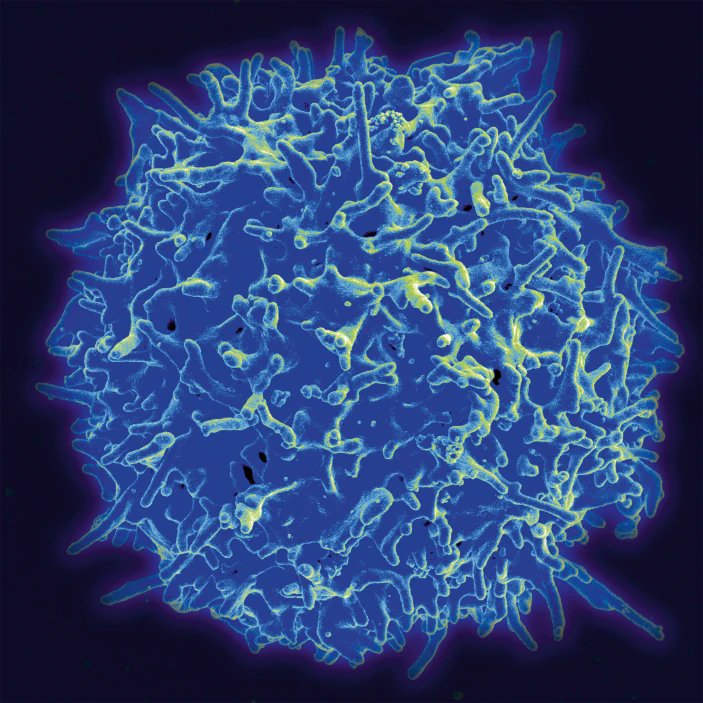 NatureBiotech's tweet photo. Treg engineers take aim at autoimmunity - @ElieDolgin https://t.co/ME97UkZVIV https://t.co/quuiYYp5oD